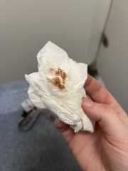 Brown clot and blood at 11+4 
