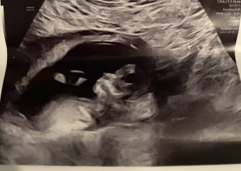 Scan help please