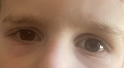 Is this hay fever?
