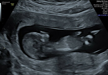 Due December 2023 part 3