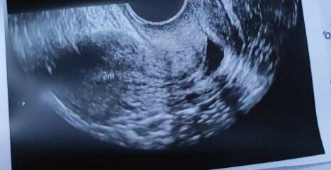 Ultrasound Help