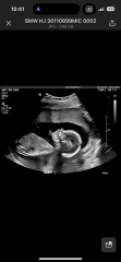 November 2023 babies - thread 4
