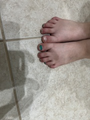 Is there something wrong with my daughter’s toes?