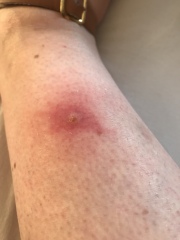 Doctor tonight? Infection or allergy?