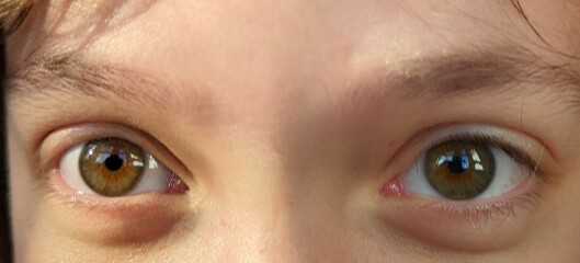 What colour would you say DD's eyes are?