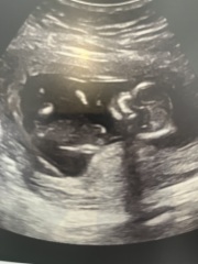Boy or Girl?