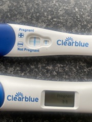Pregnancy after Ectopic. 