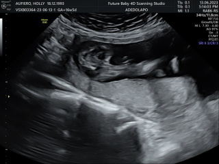 Potty shot gender confirmation??