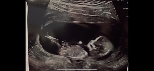 Due January 2024 🎉 PART 3
