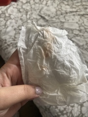 Implantation bleeding? 