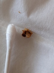 Just hooked this out of DD's ear (warning - graphic)