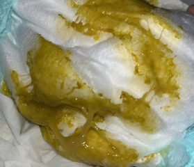 To eat dairy even though baby has suspected allergy?!