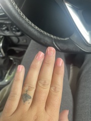 Line on nail skin c advice