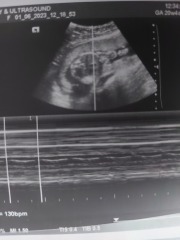 Anyone worried their private gender scan is wrong?