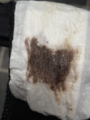 Has anyone experienced this? (Picture included)