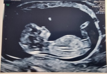 Nub theory prediction wrong?