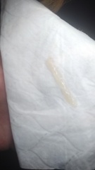 (GRAPHIC PICTURE) Is this fertile Mucus? Or Mucus Plug. sorry tmi !!!