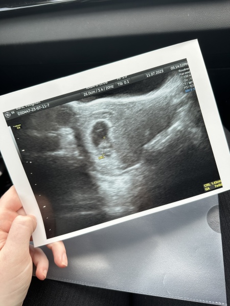 TTC May 2023 💖✨ previous MC March 2023