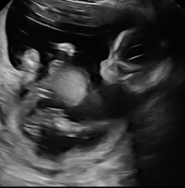 Due December 2023 part 4 