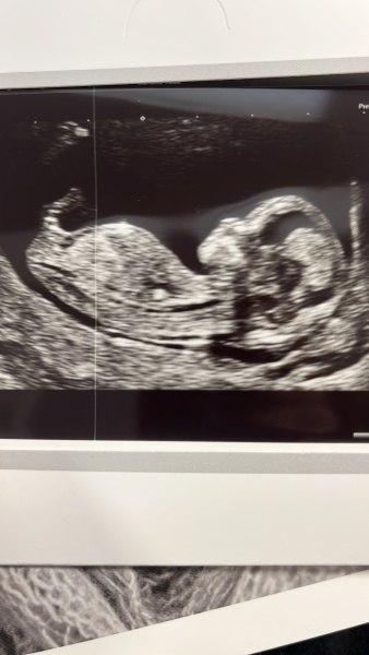 Boy or girl guesses? 