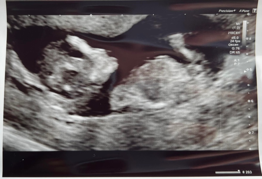 Due January Part 4! 🎉