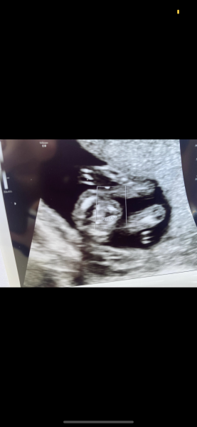 Scan pic gender predictions
