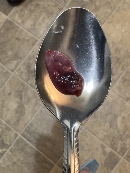 Blood clot or early miscarriage? **Content warning** Title edited by MNHQ
