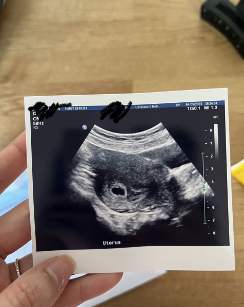 Had a early scan now I’m scared 