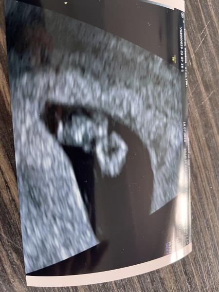 February 2024 babies 🤰 (Thread 2)