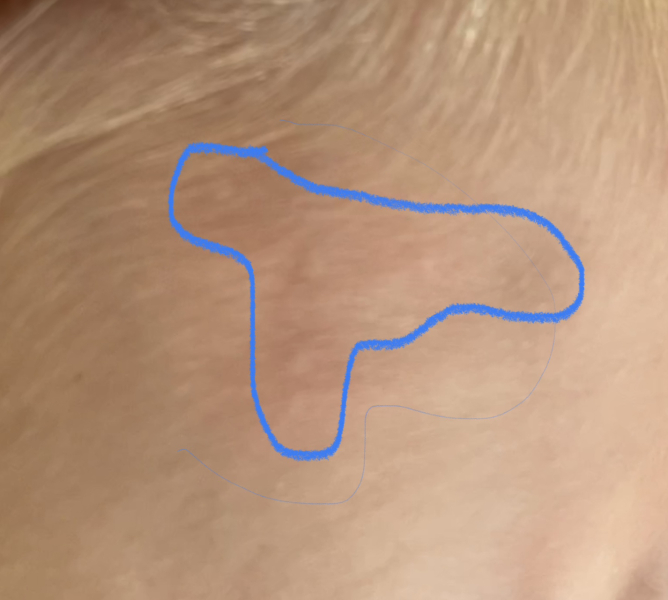 2 year old not well, how concerned should be