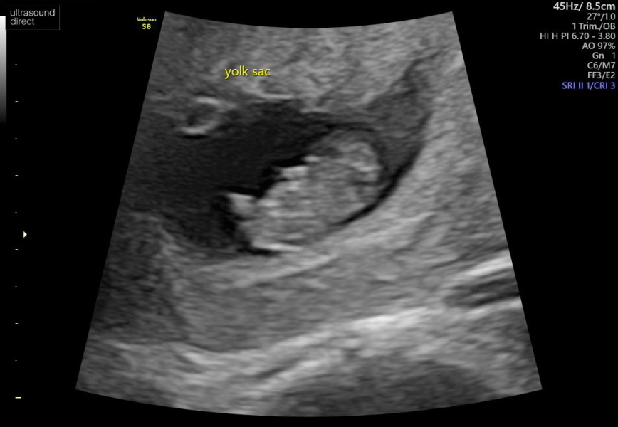 To book an early scan or wait it out?
