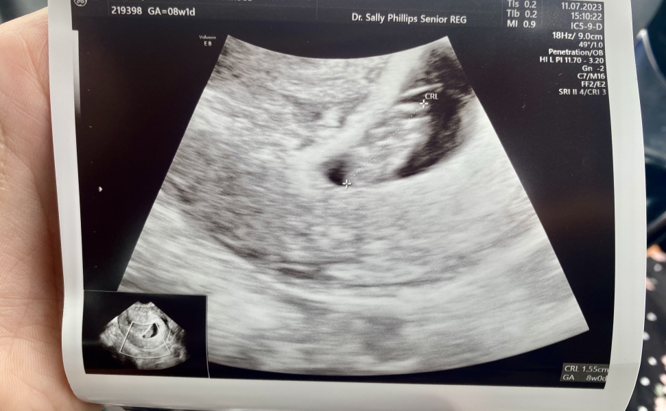 TTC May 2023 💖✨ previous MC March 2023