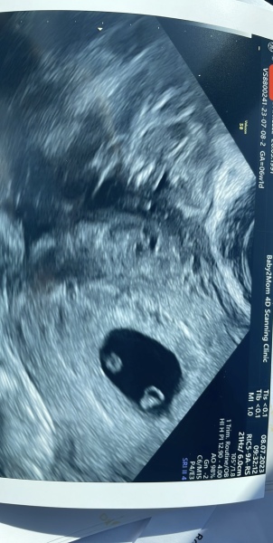 Is anyone due March 2024!? 