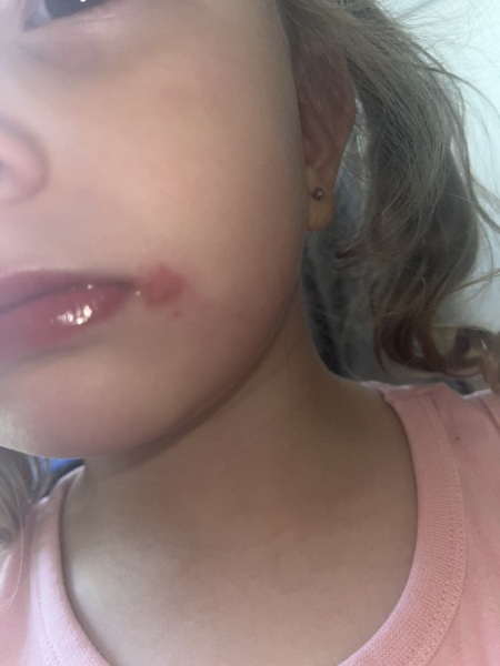 4 year old with a something red near lips