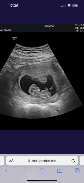 Girl or boy? Skull theory?