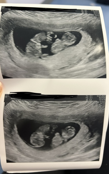 February 2024 babies 🤰 (Thread 2)