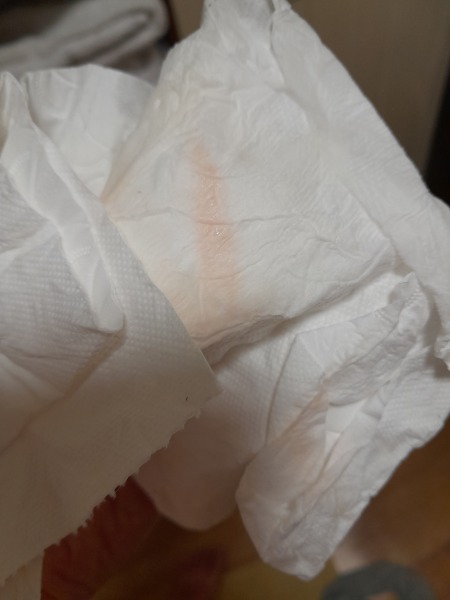 Implantation bleeding?!