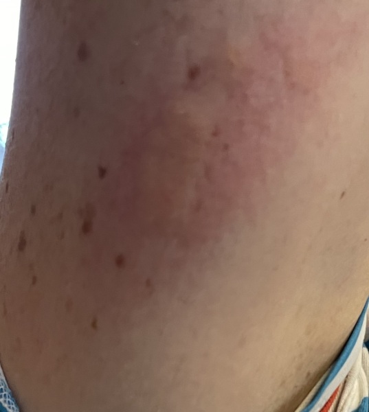What bite is this?