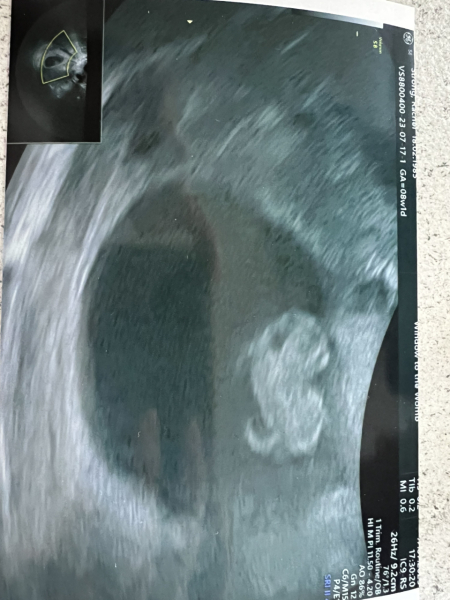 Early scan later on . . .