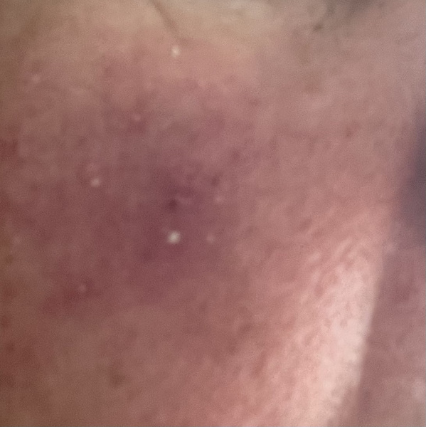 Does anyone know what these tiny white spots are?