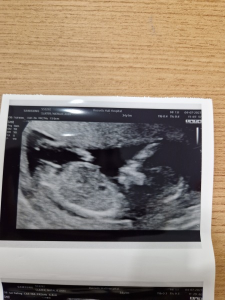 Due January Part 4! 🎉
