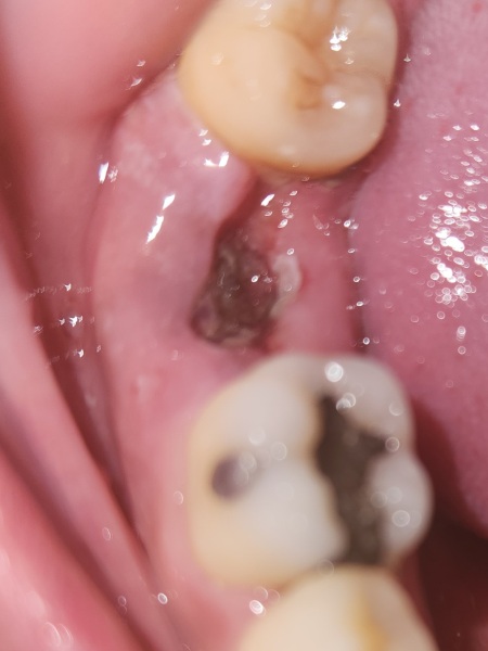 Any dentists around? Photo TMI !