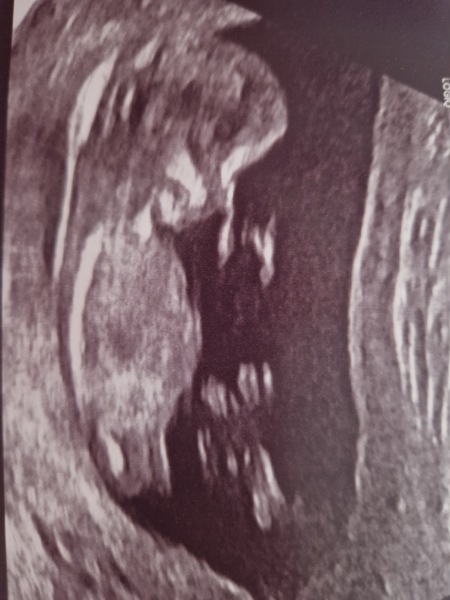 Nubs theory guesses please :)