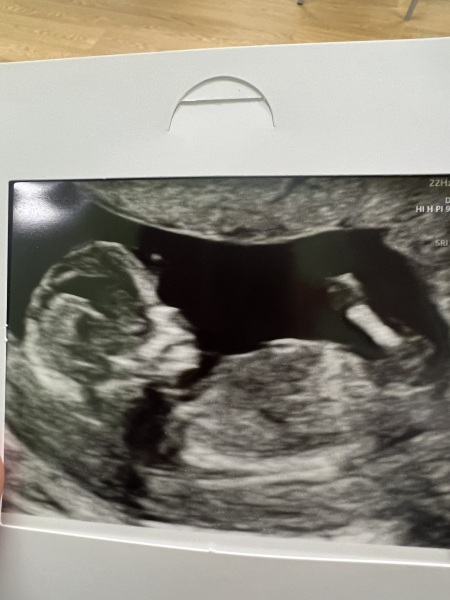 February 2024 Babies 👶 (thread 3)