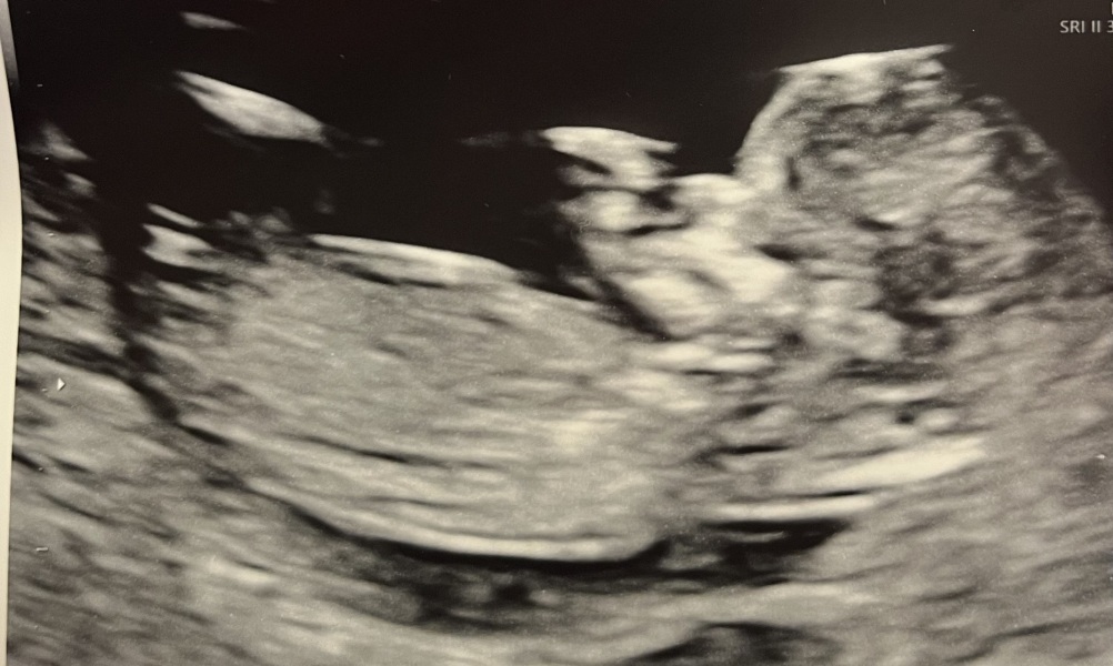 Girl or boy - any guesses please?