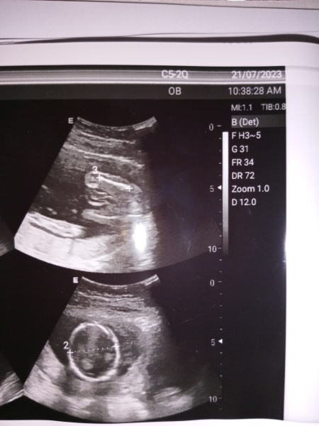 Due December 2023 part 4 
