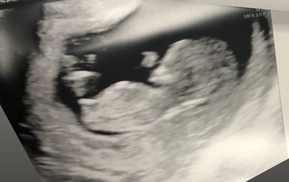 Gender guesses