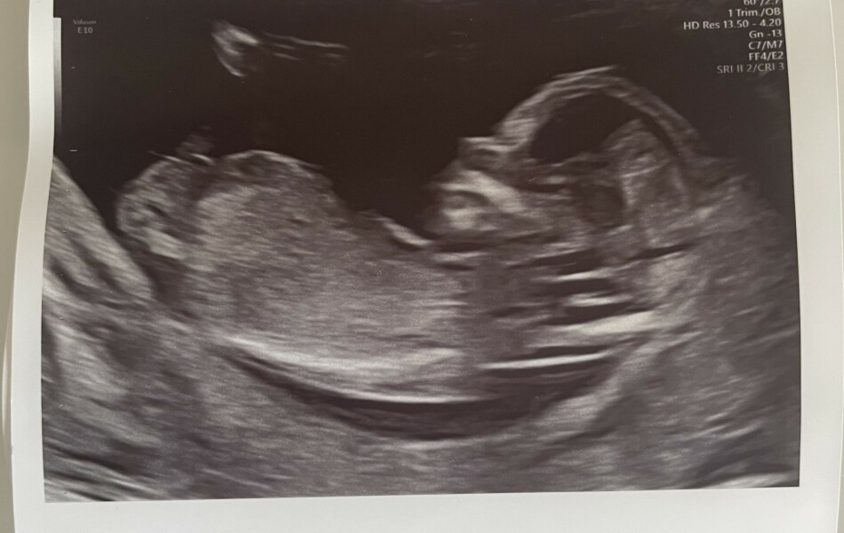 Due January Part 4! 🎉