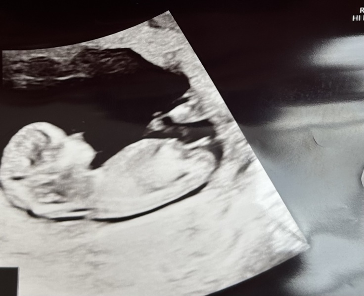 Anyone good at nub/ skull theory? Just for fun!