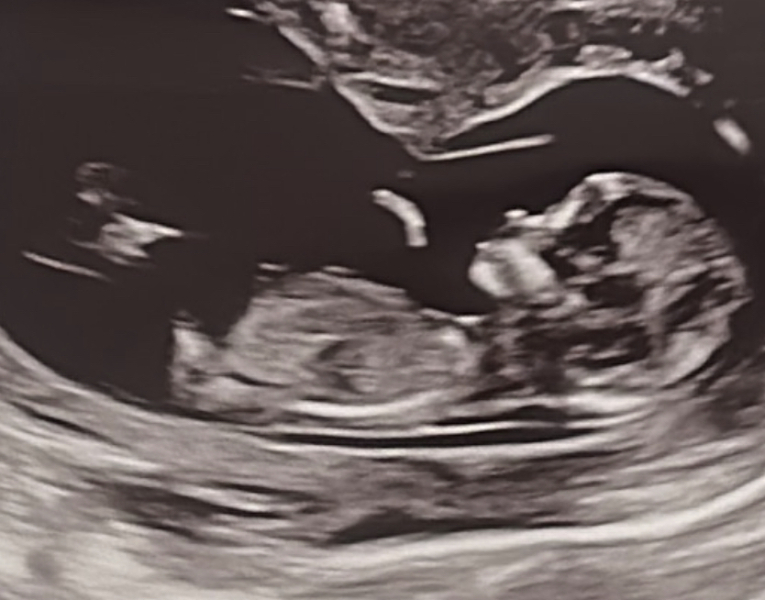 Due December 2023 part 4 